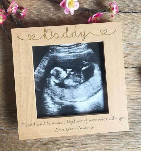 Making Memories Scan Frame - Baby Photo Pregnancy Announcement Daddy To Be Mummy Home Decor Newborn