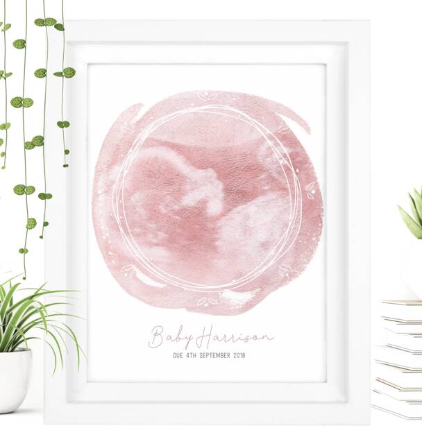 Framed Watercolour Baby Scan Print Art, Frame, Shower Gift, Ultrasound Photo, Mothers Day Gift From Bump - image 1