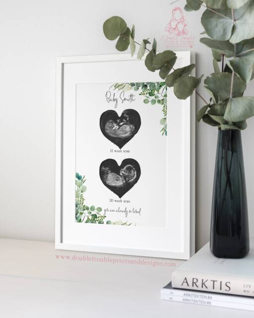 Personalized Baby Scan Print - Eucalyptus Ultrasound Art, Nursery Decor - image 1