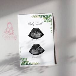 Personalized Baby Scan Print - Eucalyptus Ultrasound Art, Nursery Decor - thumbnail 3