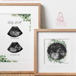 Personalized Baby Scan Print - Eucalyptus Ultrasound Art, Nursery Decor - thumbnail 2