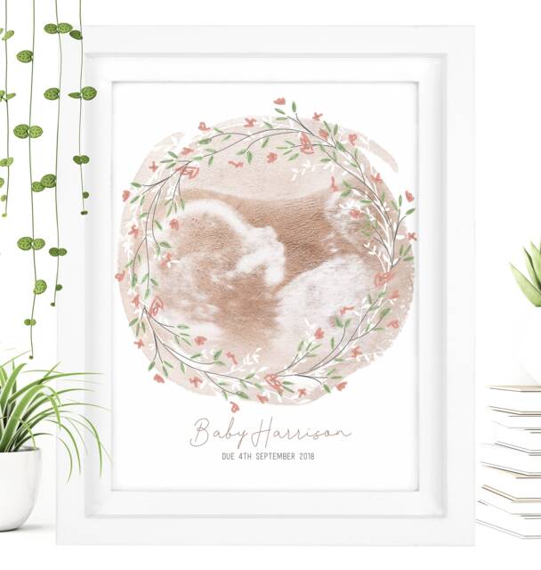 Framed Watercolour Baby Scan Print Art, Frame, Shower Gift, Ultrasound Photo, Mothers Day Gift From Bump - image 1