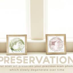 Framed Watercolour Baby Scan Print Art, Frame, Shower Gift, Ultrasound Photo, Mothers Day Gift From Bump - thumbnail 4