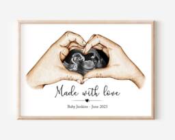 Personalised Pregnancy Scan Print Gift - Unframed Baby Shower Ultrasound - thumbnail 1