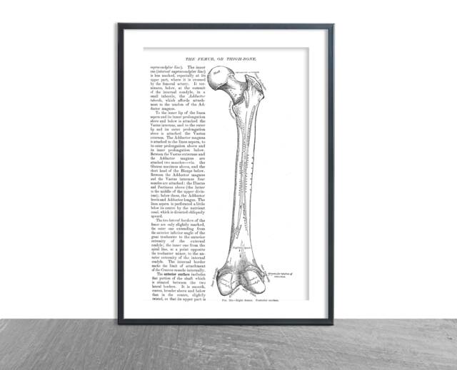 Anatomy Femur Thigh Bone D??cor Anatomical Art Patent Prints, Medical School Student Wall Art Poster Nurse Doctor Surgeon - Antique Bones - image 1