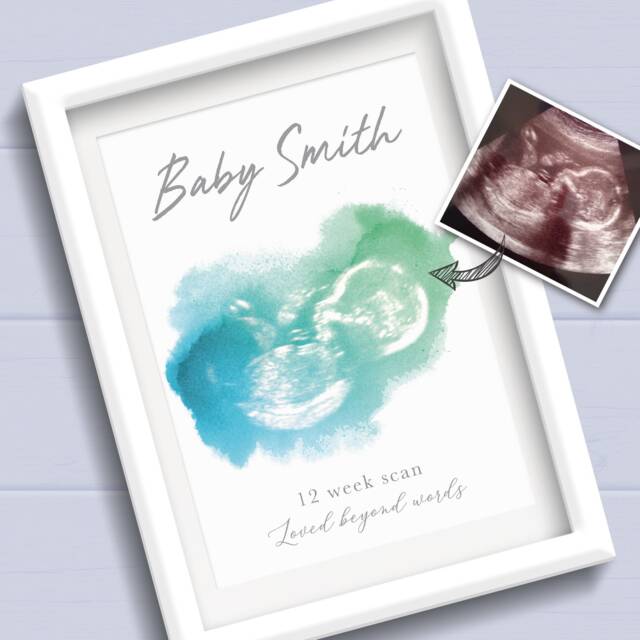 Baby Scan Print. Ultrasound Or Sonogram Art Scan Keepsake. Pregnancy Gift For Mum To Be. Gender Reveal Announcement. Shower - image 1
