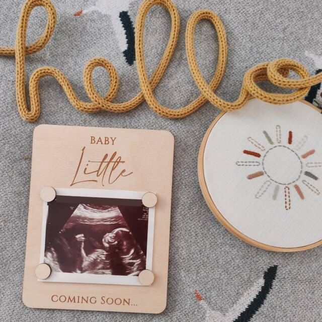 Scan Photo Frame - Magnetic Scan Holder Pregnancy Announcement Flat Lay Prop Nursery Decor - image 1
