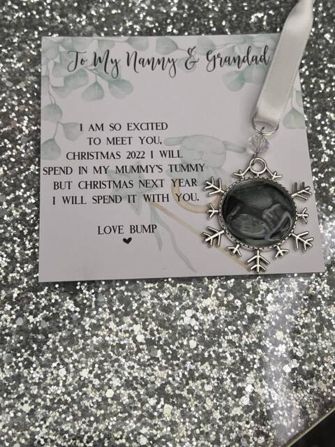 Personalised Ultrasound Baby Scan Photo Christmas Tree Bauble/stocking Filler/xmas Gift/I'm On My Way/Love Bump/xmas/Excited To Meet You - image 1