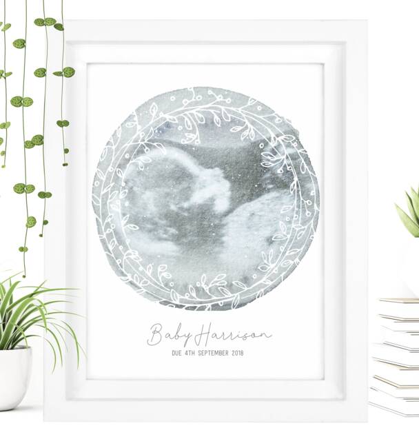 Framed Watercolor Baby Scan Art Print, Ultrasound Gift - image 1