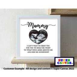 Baby Ultrasound Pregnancy Scan Personalised Photo Picture Framed Print For New Parent Daddy Mummy Mum To Be Shower Christmas Gift - thumbnail 3