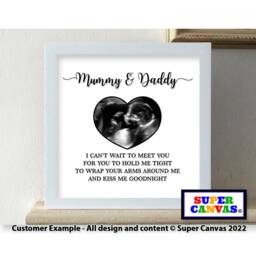 Baby Ultrasound Pregnancy Scan Personalised Photo Picture Framed Print For New Parent Daddy Mummy Mum To Be Shower Christmas Gift - thumbnail 2