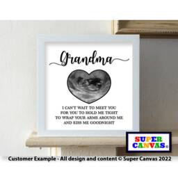 Baby Ultrasound Pregnancy Scan Personalised Photo Picture Framed Print For New Parent Daddy Mummy Mum To Be Shower Christmas Gift - thumbnail 4