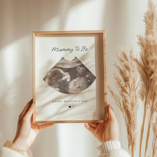Personalised Baby Scan Print Expectant Mother Gift, Ultrasound Photo Keepsake - image 1