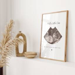 Personalised Baby Scan Print Expectant Mother Gift, Ultrasound Photo Keepsake - thumbnail 3