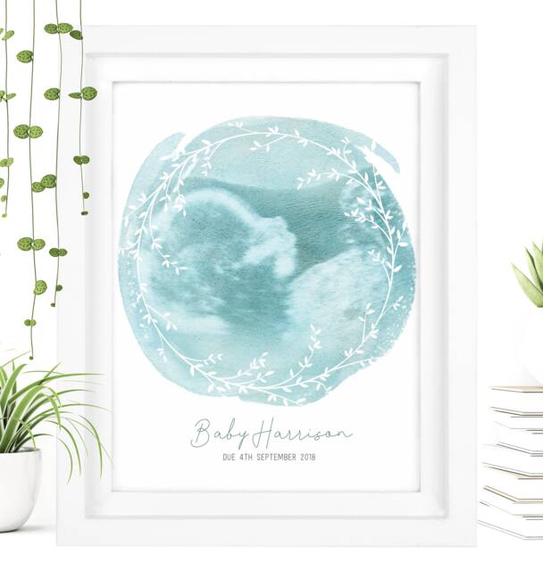 Framed Watercolour Baby Scan Print Art, Frame, Shower Gift, Ultrasound Photo, Mothers Day Gift From Bump - image 1