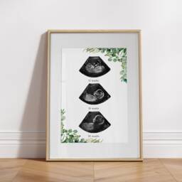 Personalized Baby Scan Print - Botanical Ultrasound Art, Pregnancy Gift - thumbnail 3
