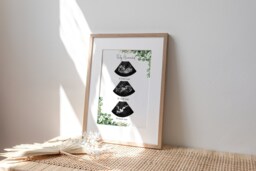 Personalized Baby Scan Print - Botanical Ultrasound Art, Pregnancy Gift - thumbnail 1