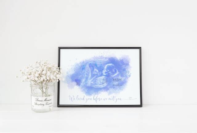 Watercolor Ultrasound Art Print Baby Scan Photo Keepsake - image 1
