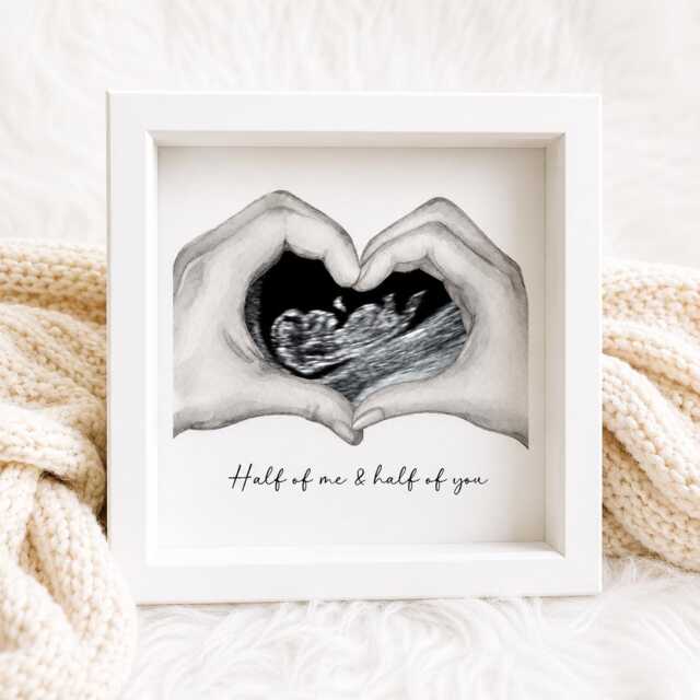 Personalised Ultrasound Scan Photo Box Frame, Handmade Keepsake Gift - image 1