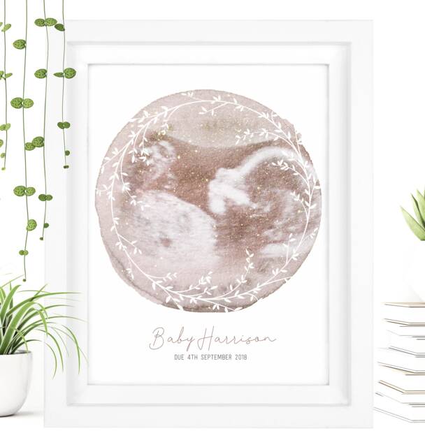 Framed Watercolour Baby Scan Print Art, Frame, Shower Gift, Ultrasound Photo, Mothers Day Gift From Bump - image 1