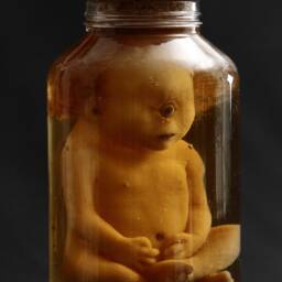 Taxidermy Cabinet Of Curiosities Fetus Cyclops Oddities - thumbnail 4