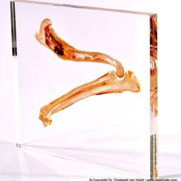 Real Anatomical Ttt - Sheet Plastinate Plastinated Anatomy Specimen By Dr. Von Horst Exhibition Quality Acrylic Embedded Body Slice Se20 - thumbnail 4