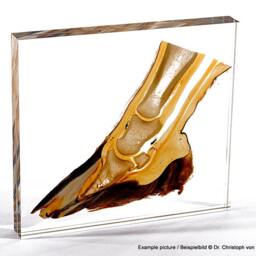 Real Anatomical Ttt - Sheet Plastinate Plastinated Anatomy Specimen By Dr. Von Horst Exhibition Quality Acrylic Embedded Body Slice Se20 - thumbnail 2