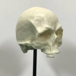 1/6Th Scale Bone Just A Few Teeth Resin Human Skull - thumbnail 2
