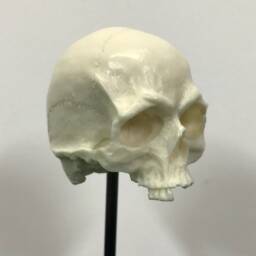 1/6Th Scale Bone Just A Few Teeth Resin Human Skull - thumbnail 4