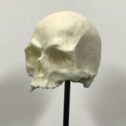 1/6Th Scale Bone Just A Few Teeth Resin Human Skull - thumbnail 3