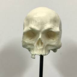 1/6Th Scale Bone Just A Few Teeth Resin Human Skull - thumbnail 1