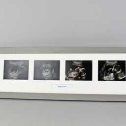 Baby Scan Photo Frame - Landscape Multi For Four Sized Photos & One Text Box. Handmade. Shower - Pregnancy Announcement - thumbnail 3