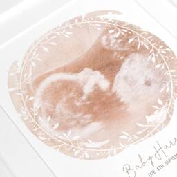Framed Watercolour Baby Scan Print Art, Frame, Shower Gift, Ultrasound Photo, Mothers Day Gift From Bump - thumbnail 3
