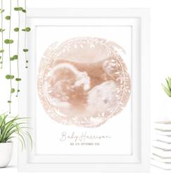Framed Watercolour Baby Scan Print Art, Frame, Shower Gift, Ultrasound Photo, Mothers Day Gift From Bump - thumbnail 1