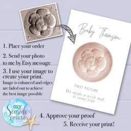 Personalized Ivf Embryo Watercolor Print Baby Announcement Keepsake - thumbnail 3