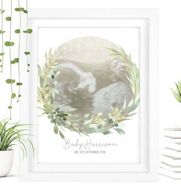 Framed Watercolour Baby Scan Print Art, Frame, Shower Gift, Ultrasound Photo, Mothers Day Gift From Bump - image 1