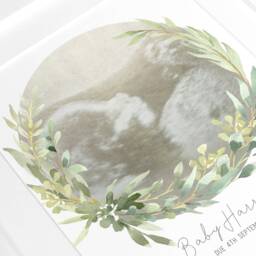 Framed Watercolour Baby Scan Print Art, Frame, Shower Gift, Ultrasound Photo, Mothers Day Gift From Bump - thumbnail 2