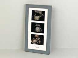 Baby Scan Photo Frame - Multi Aperture For Three Sized Photos & Text Box. Handmade. Shower Gift - Pregnancy Announcement - thumbnail 1