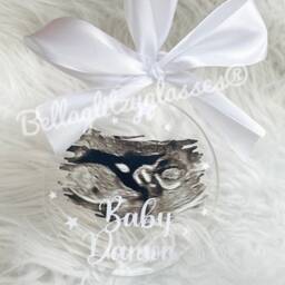 Personalized Baby Scan Photo Christmas Bauble Custom Ornament - thumbnail 2