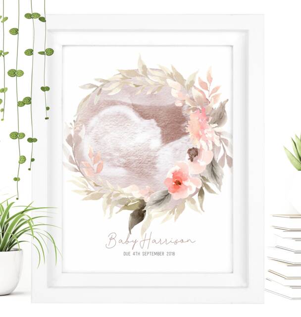 Framed Watercolour Baby Scan Print Art, Frame, Shower Gift, Ultrasound Photo, Mothers Day Gift From Bump - image 1