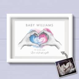 Pregnancy Keepsake, Personalised Baby Scan Print, Gift For Mum To Be From The Bump, 4D Print. My First Scan - thumbnail 1