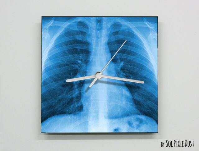 x-Ray Lungs Wall Clock - image 1