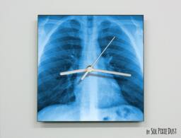 x-Ray Lungs Wall Clock - thumbnail 1