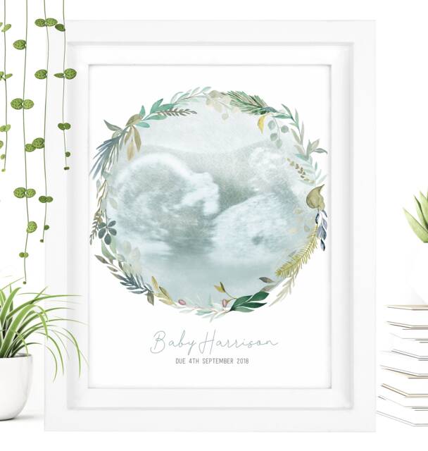Framed Watercolour Baby Scan Print Art, Frame, Shower Gift, Ultrasound Photo, Mothers Day Gift From Bump - image 1