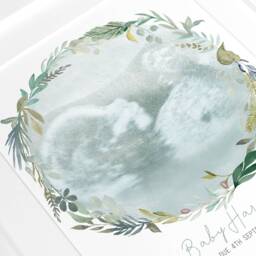 Framed Watercolour Baby Scan Print Art, Frame, Shower Gift, Ultrasound Photo, Mothers Day Gift From Bump - thumbnail 3