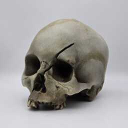Axed. Human Skull Replica . Realistic Plaster Of Paris Life Size Replica - thumbnail 3
