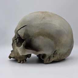 Axed. Human Skull Replica . Realistic Plaster Of Paris Life Size Replica - thumbnail 4