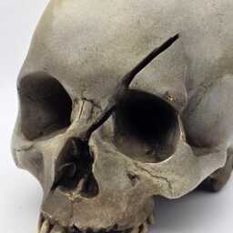 Axed. Human Skull Replica . Realistic Plaster Of Paris Life Size Replica - thumbnail 2
