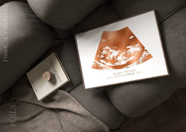 Foil Baby Ultrasound Print Rose Gold Keepsake, Dad-To-Be Gift - image 1