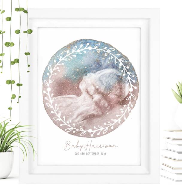 Framed Watercolour Baby Scan Print Art, Frame, Shower Gift, Ultrasound Photo, Mothers Day Gift From Bump - image 1